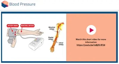 Basic Observation blood pressure