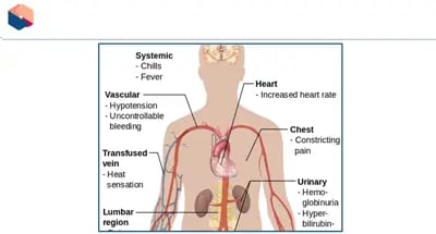 Blood Transfusions diagrams