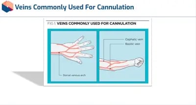 Cannulation Veins Commonly Used