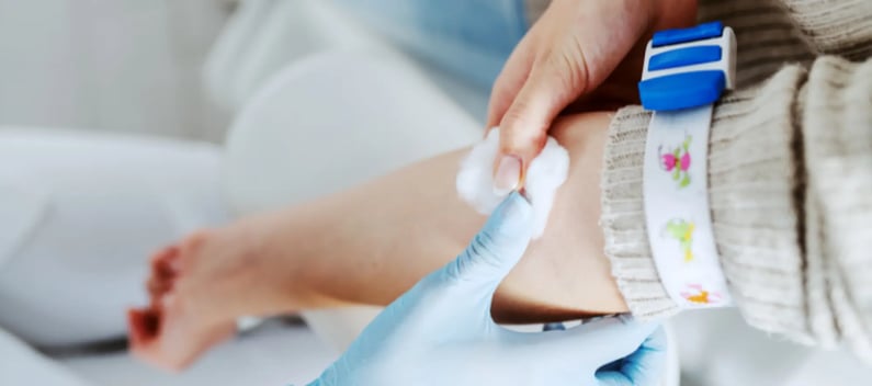 Cotton wool over puncture site after venepuncture