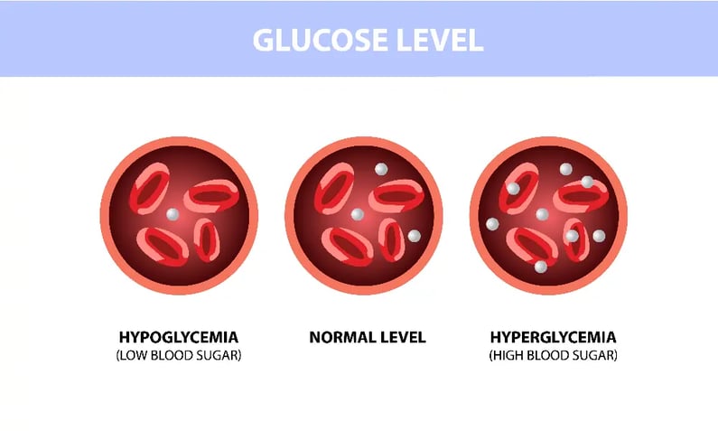Glucose level diabetes hyperglycemia hypoglycemia
