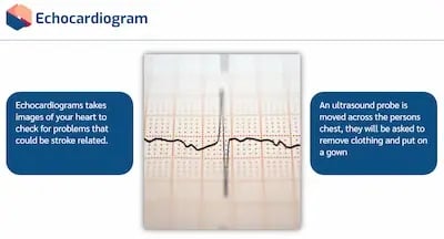 Stroke Awareness echo
